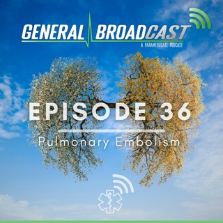 Pulmonary Embolism