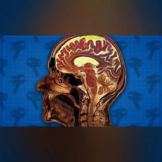Are AirPods Strong Enough to Fry Your Brain?