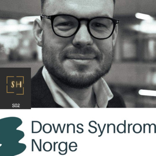 Verdensdagen- spesial: La oss snakke om: Downs syndrom