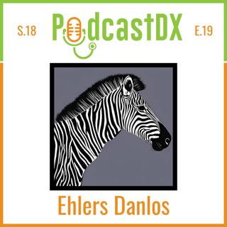 Intro to Ehlers Danlos Syndrome