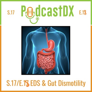 EDS & Gut Dysmotility