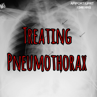 PFC Podcast: When to Watch and When to Treat Pneumothorax