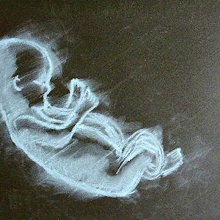 Is America turning on abortion?