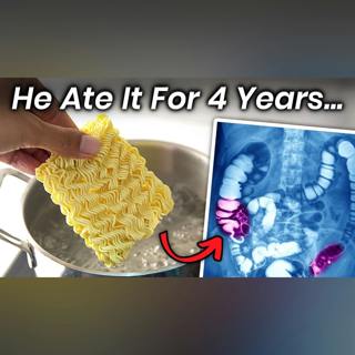 A Boy Ate Instant Noodles for 4 Years, This Is What Happened to His Stomach