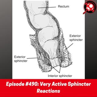 #490: Very Active Sphincter Reactions