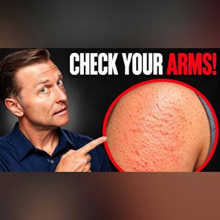 The One Deficiency Behind Dry Eyes, Dry Mouth, and Bumpy Arms