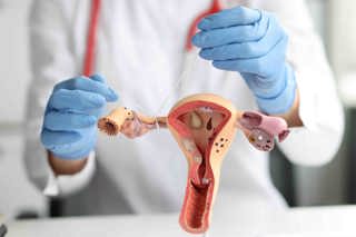 366. Tubal Ligation