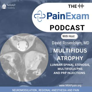 Using PRP or PNS to Treat Back Pain related to Multiifdus Atrophy