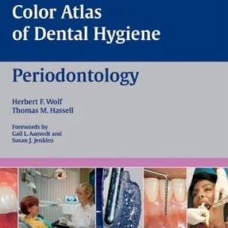 Color Atlas of Dental Hygiene: Periodontology