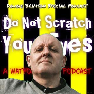 Do Not Scratch Your Eyes - Dougie Brimson Special - S2 Ep19