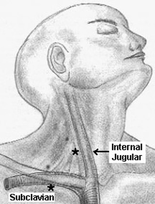 Podcast #236: Peripheral IJ Access