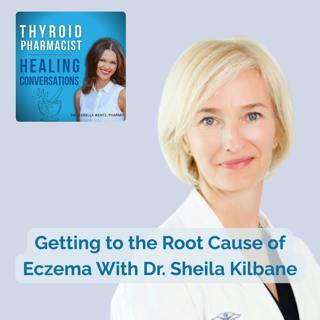59: Getting to the Root Cause of Eczema With Dr. Sheila Kilbane