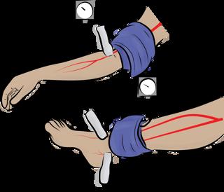 Examination of the Peripheral Pulses