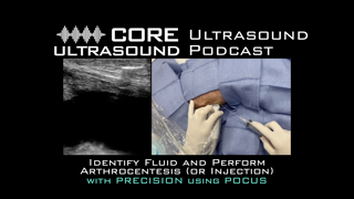 Tackle that swollen joint with ultrasound (and drain it with accuracy)