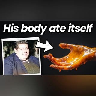The Man Who Let His Body Eat Itself
