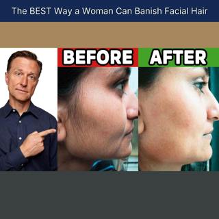 The BEST Way a Woman Can Banish Facial Hair