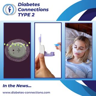 In the News... Inhaled Insulin Studied for Kids, Dexcom Launches AI, App for Driving & T1D, and more!
