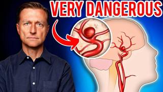 Aneurysms: The Silent Killer 