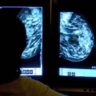 The Happy Pod: Kinder medicine for millions of cancer patients