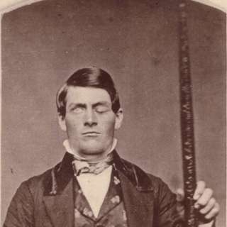 Hardhauser