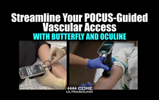 Streamline Your POCUS-guided Vascular Access with Butterfly and Oculine