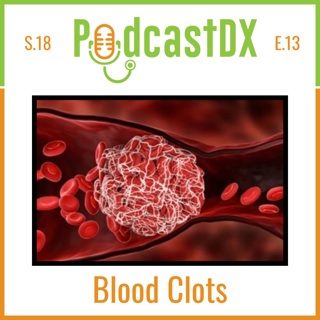 Blood Clots