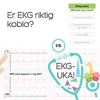 01 Er EKG riktig kobla?