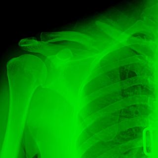 Who is Clavicular?