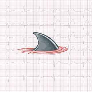 Hva er EKG?