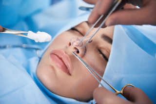 367. Rhinoplasty