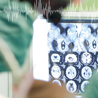 Innovations in Functional Brain Imaging to Improve Neurosurgery - Dr Jun Hua, Johns Hopkins University