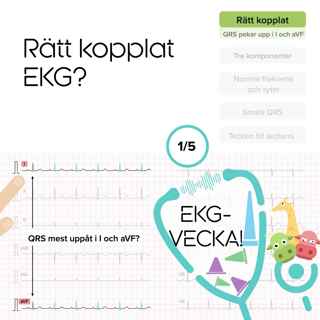 01 Rätt kopplat EKG?