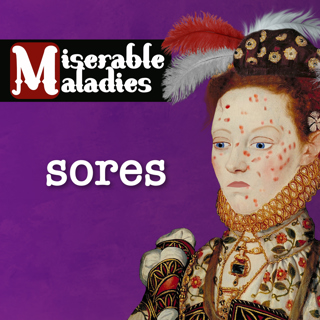 Tudor Time Machine's Miserable Maladies: Sores