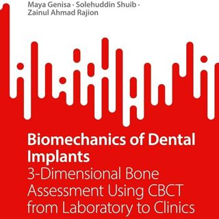 Biomechanics of Dental Implants: 3-Dimensional Bone Assessment Using CBCT from Laboratory to Clinics