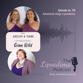 Ep 112 ~ Lipoedema Warrior Gian Wild