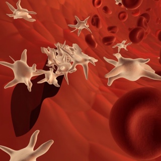 Platelet Transfusion