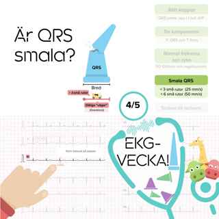 04 Är QRS smala?