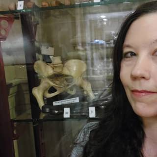 Därför konserverade läkare kroppsdelar på 1800-talet