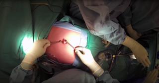 Guide to Laparoscopic Surgery: Cooking Laparoscopy