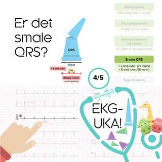 04 Er det smale QRS?