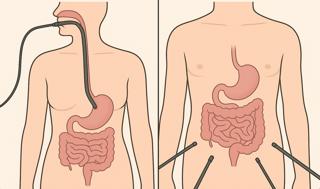 436. Endoscopy vs Laparoscopy and the Beginnings