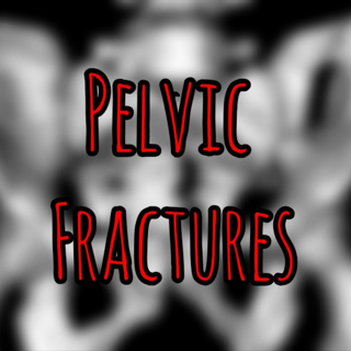 PFC Podcast 275: Mastering Pelvic Fracture Management