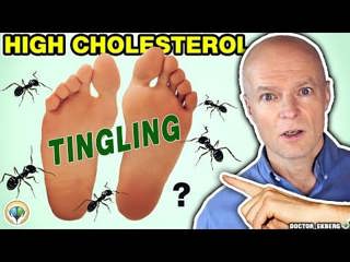 10 Common Signs of High CHOLESTEROL You MUST NOT Ignore