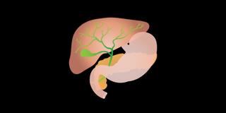 301. Management of Acute Cholecystitis