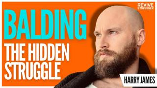 487: The Hidden Psychological Impact of Balding - Harry James