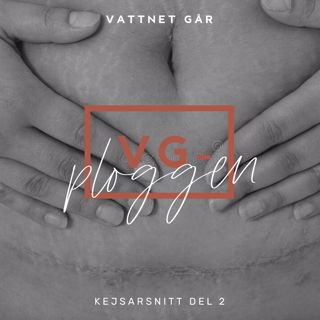 263. VG-ploggen - Kejsarsnitt del 2, Det händer efter snittet