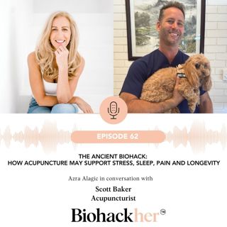 The Ancient Biohack: How Acupuncture May Support Stress, Sleep, Pain and Longevity