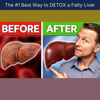 The #1 Best Way to DETOX a Fatty Liver
