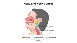 Booking Health Releases 2026 Report on Advanced Head and Neck Cancer Treatment for International Patients