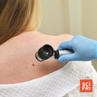What an mRNA melanoma vaccine may mean for cancer treatment